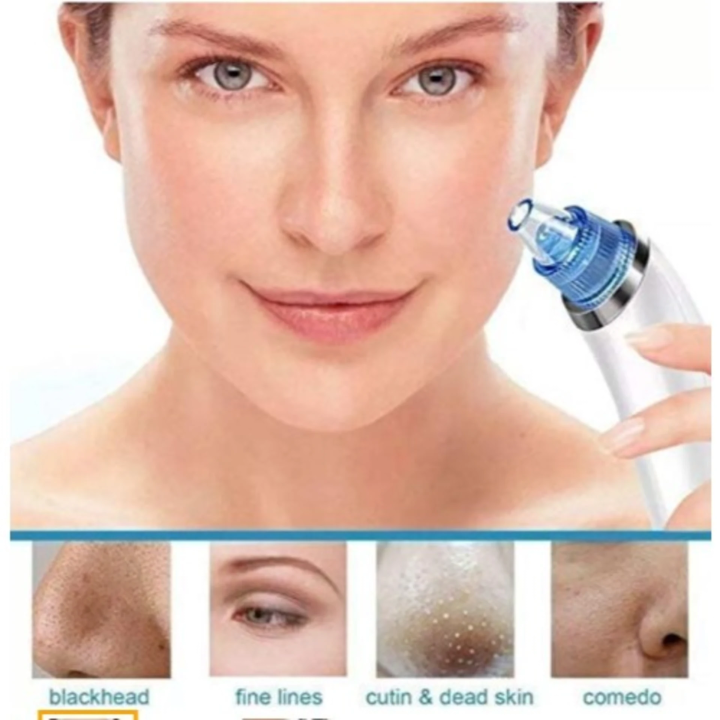 Derma Suction Pore Cleaner and Blackhead Remover